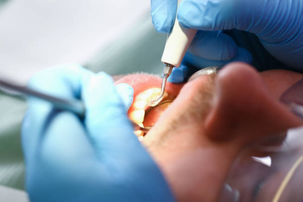 Best Emergency Treatment for Toothache in Upper Fruitland, NM