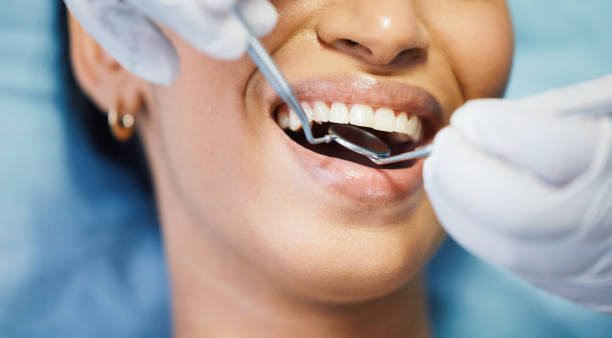 Best Emergency Broken Tooth Repair in Upper Fruitland, NM