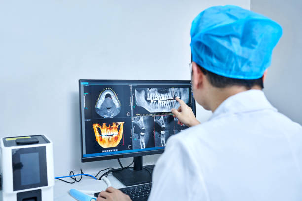 Best Emergency Tooth Extraction in Upper Fruitland, NM